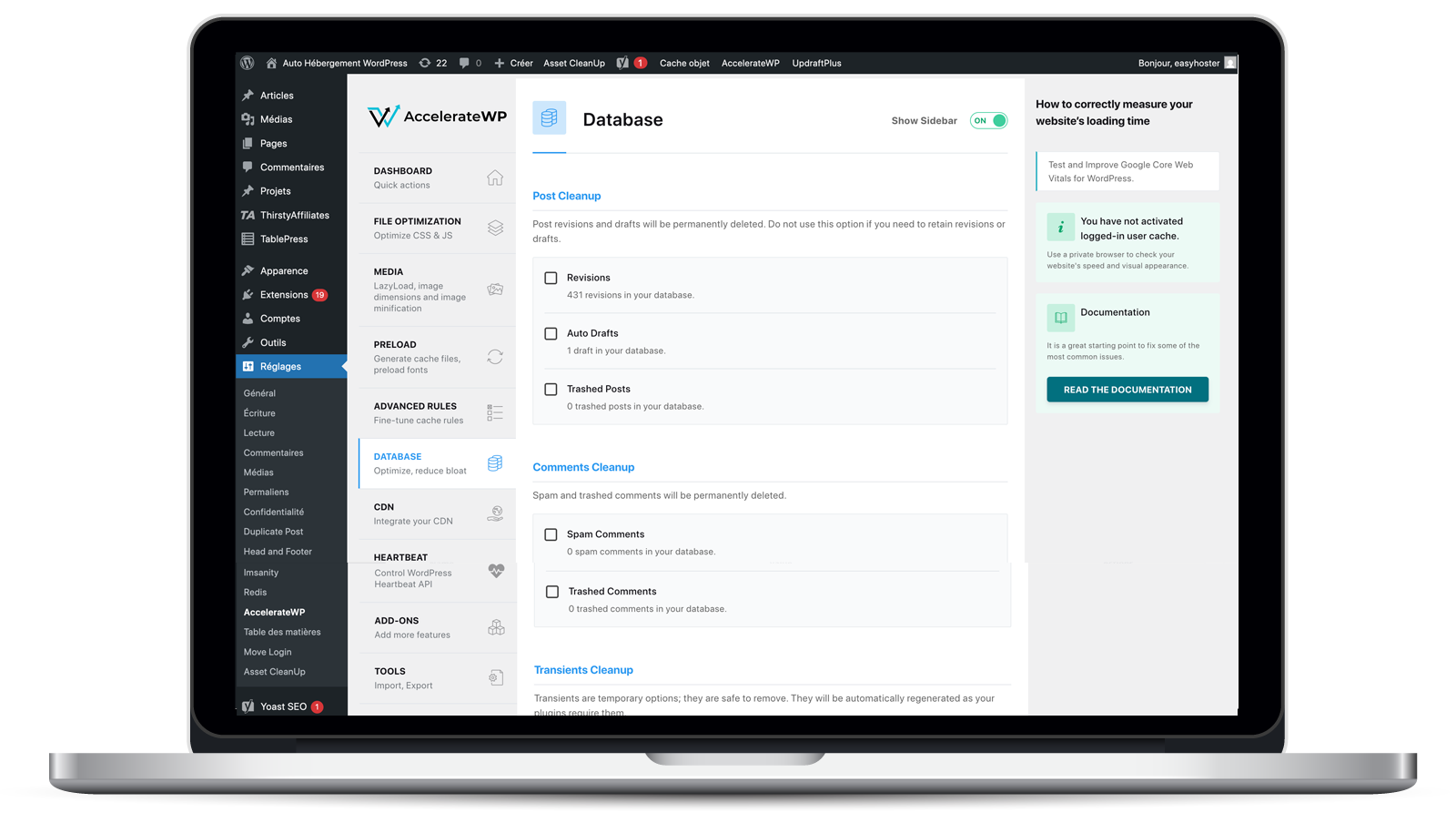 AccelerateWP offre aussi des options d'optimisation de base de données